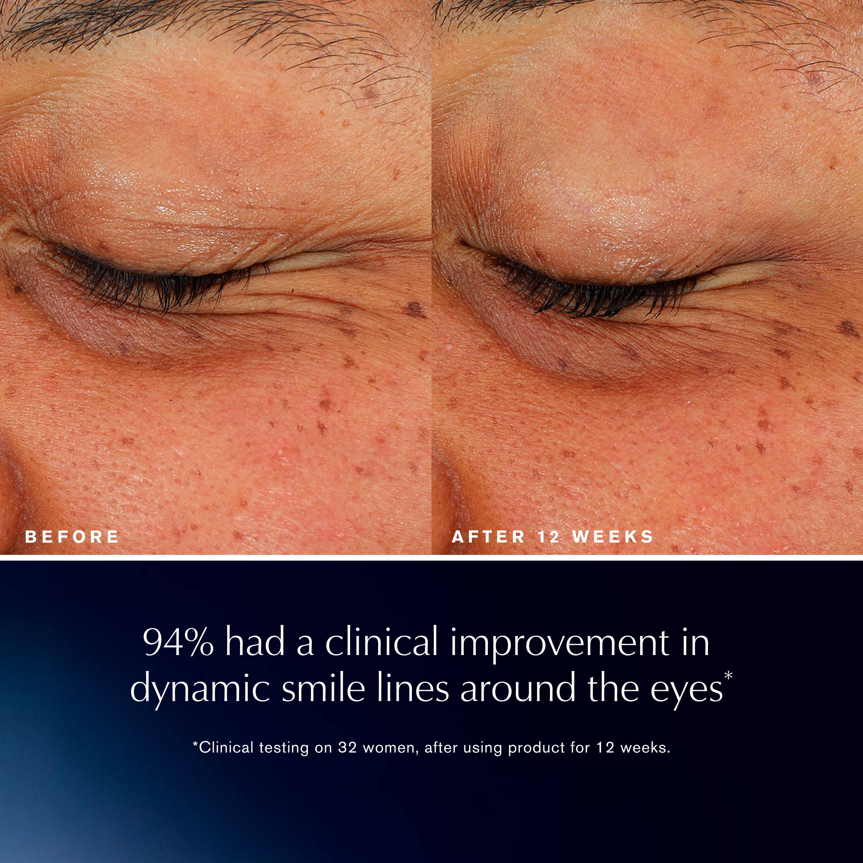 Advanced Night Repair Eye Lift + Sculpt Eye Cream