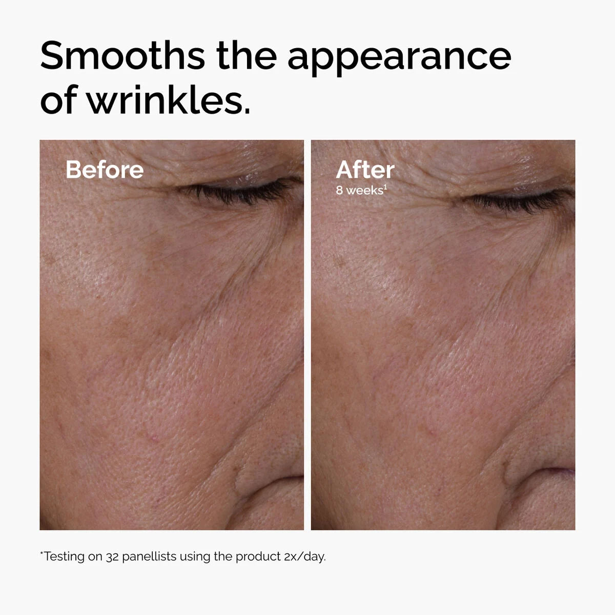 Multi-Peptide + HA Serum 30ML