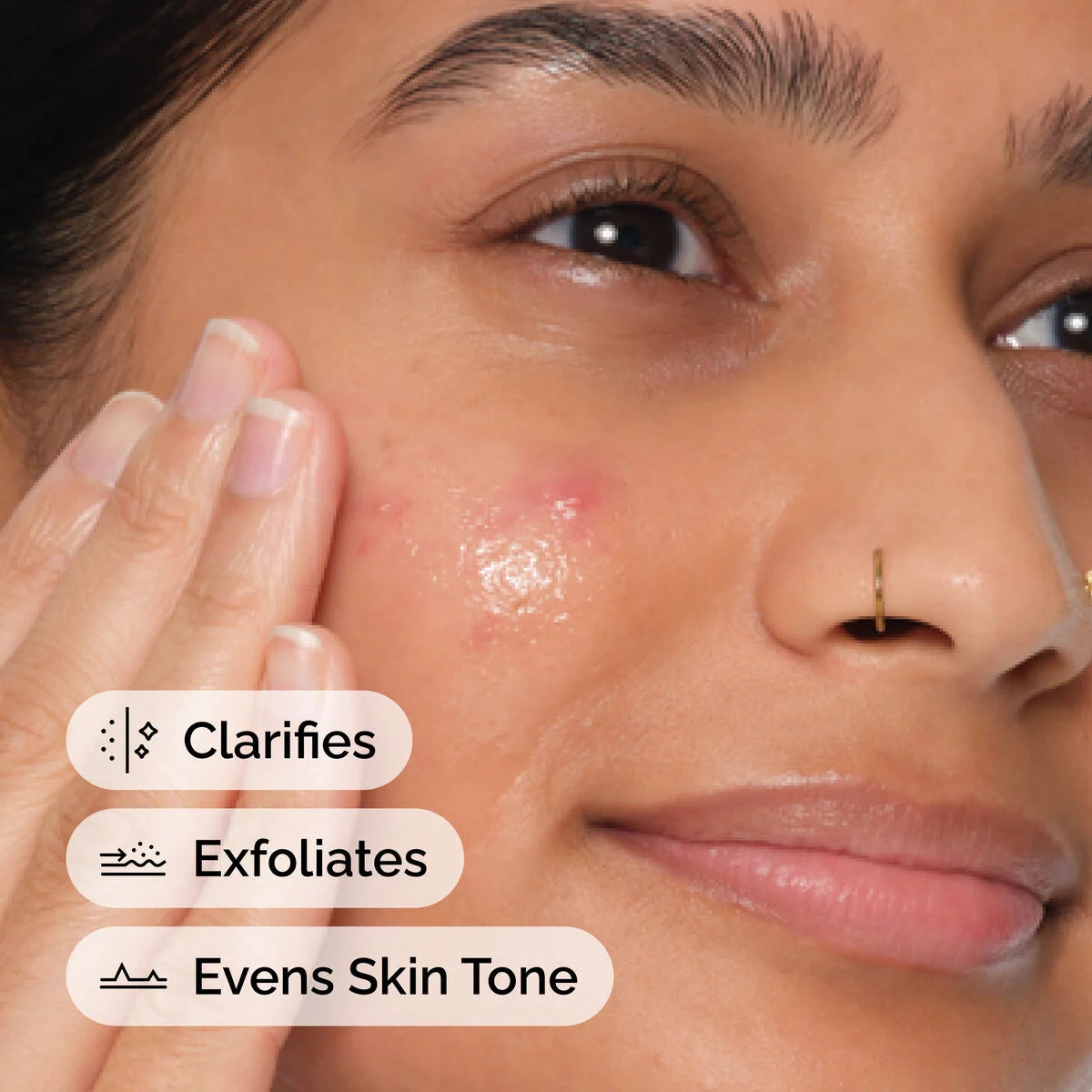 Salicylic Acid 2% Anhydrous Solution 30ML