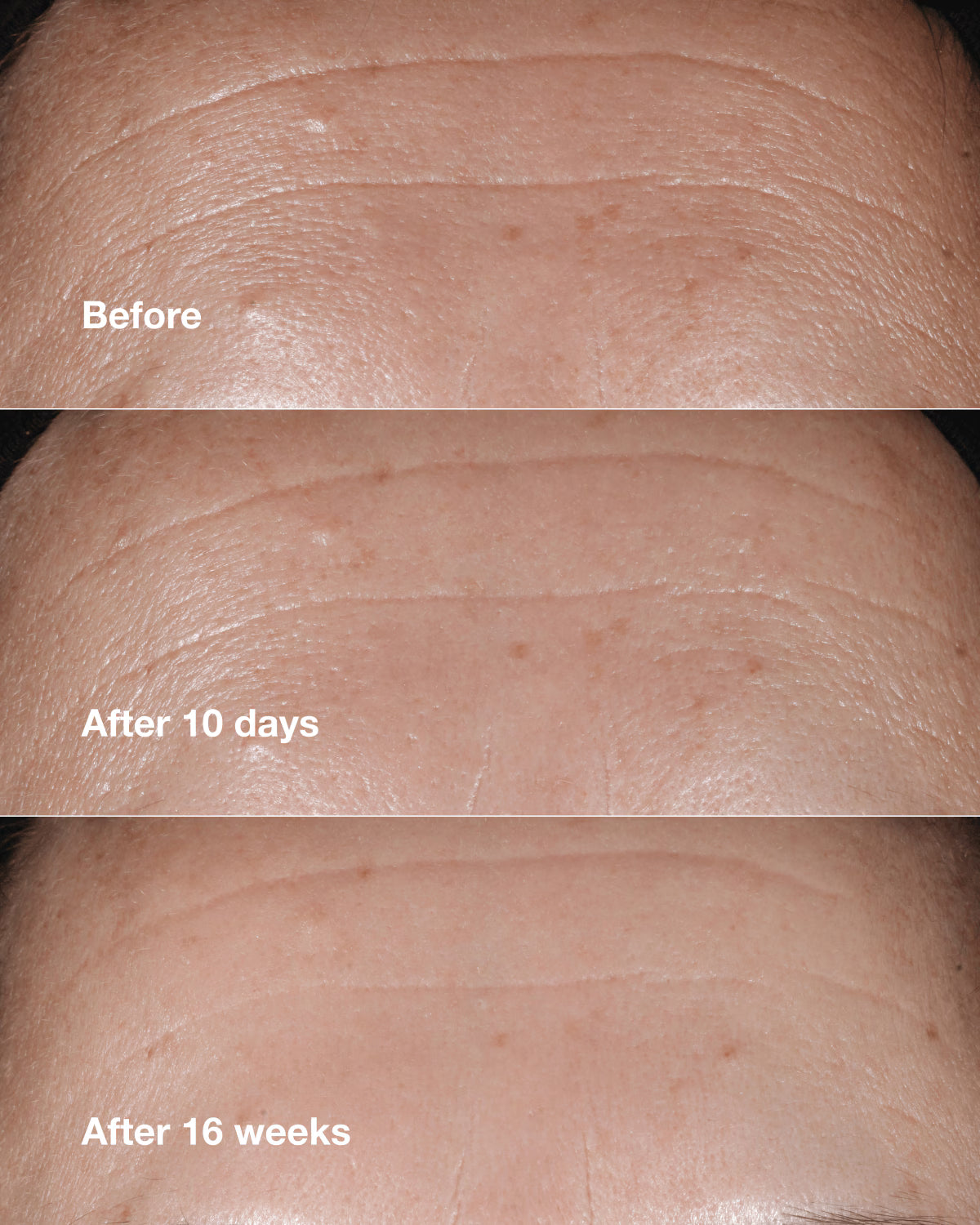 CL SMART CLNCL SERUM 10ML