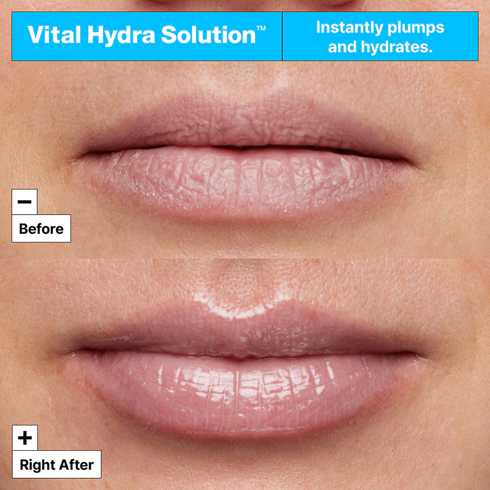 Vital Hydra Solution™ Lip Mask 20 ML